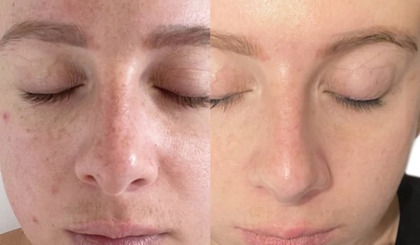 BA67_3DAESTHETICS_DMF_FACE_X1