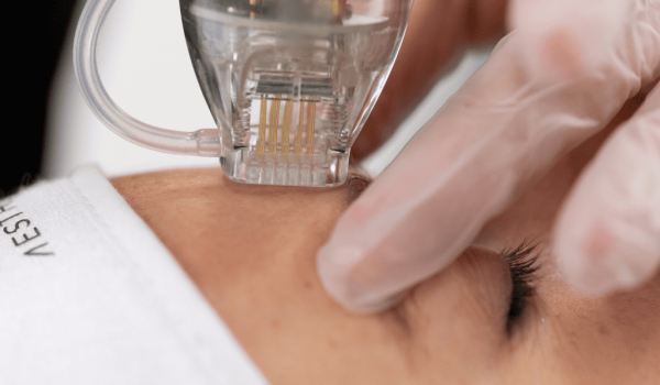 Dermafource-1024x601 (1)