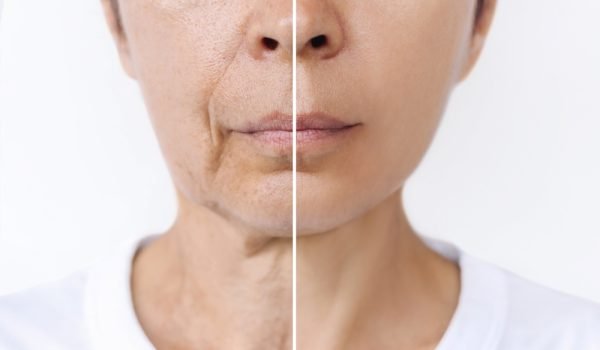 Lower,Part,Of,Face,And,Neck,Of,Elderly,Woman,With